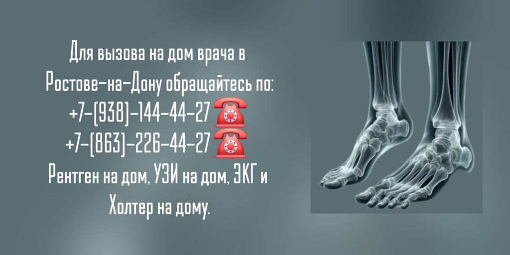 Рентген костей и суставов в Ростове-на-Дону - Вызов на дом
