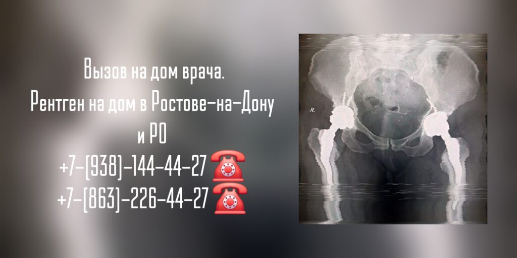 Ростов-на-Дону и Ростовская область рентген- вызов на дом