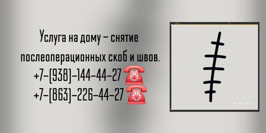 Вызов врача на дом для снятия послеоперационных швов и скоб 
